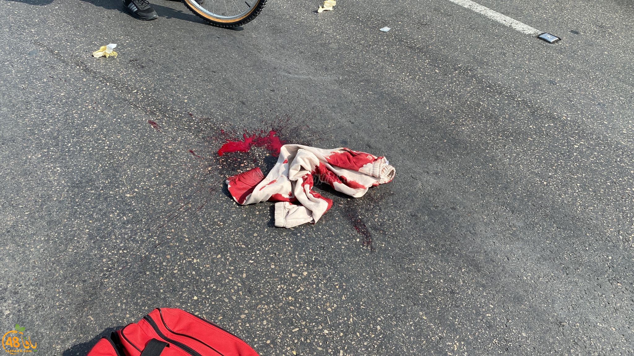 يافا: اصابة متوسطة لراكب دراجة هوائية بحادث ذاتي