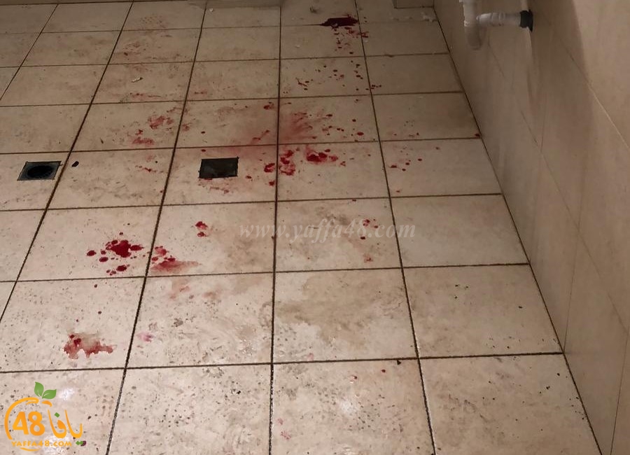 اصابة 5 طلاب بجراح متفاوتة اثر تعرضهم للطعن داخل مدرسة بجلجولية 