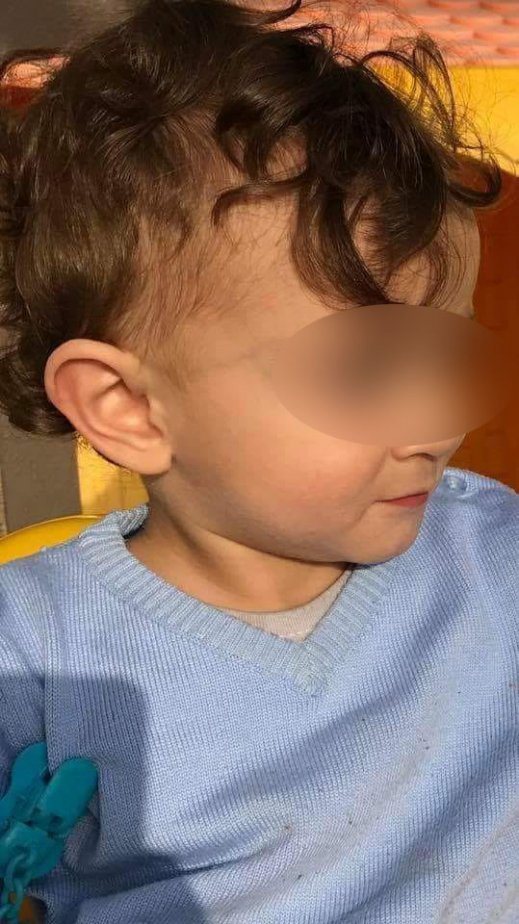 والد من كفركنا: طفلي تعرض لحروق خطيرة في جسمه خلال تواجده في الحضانة