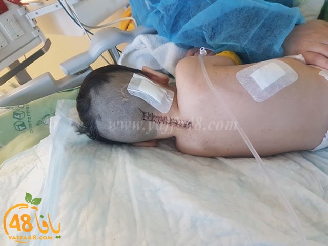  الرملة: الطفل عمار محمد المصري يتماثل للشفاء ويخرج من المستشفى 