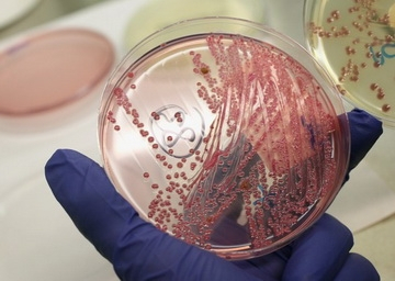 يابانيون يكتشفون بكتريا قادرة على أكل البلاستيك