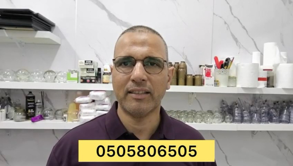 اليوم يبدأ أول أيام الحجامة لهذا الشهر .. لا تفوتوا الفرصة مع الاختصاصي موسى أبو سريس