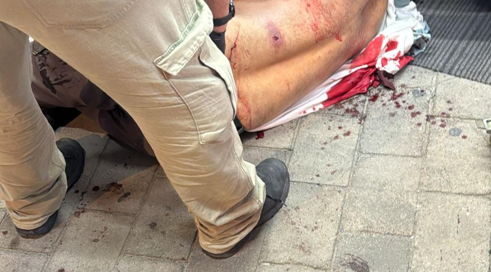 الرملة: اصابة خطرة في حادث سطو يعقبه اطلاق نار.