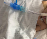 يافا: عائلة سكسك تطلب من الأهالي الدعاء لطفلتهم المريضة سميرة