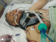  أنقذوا حياة السيد أشرف منصور من قلقيلة بعد تعرضه لحادث عمل 