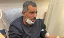 متطرفون يهود يعتدون على شاب من رهط