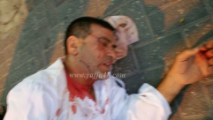 صور: الاعتداء بالضرب المبّرح على السيد عماد أبو شرخ "أبو تامر" من اللد بعد عودته من صلاة الفجر 