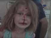 فيديو مؤلم: طفلة سورية تبكي وتنادي على والدها وهي تنزف