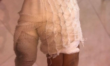 زلفة: اصابة طفل بحروق من الدرجة الثالثة اثر انفجار مفرقعات في يده 