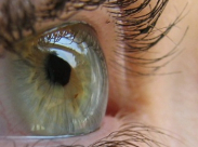 «الخلايا الجذعية للعين».. تقنية جديدة تحارب العمى