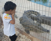  تحسّن يطرأ على حالة الطفل من مدينة يافا بعد عضّه بواسطة تمساح