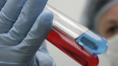 روسيا تبدأ اختبار لقاح كورونا