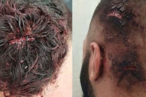 اعتقال عنصري اعتدى على ثلاثة شبان من شفاعمرو لأنهم عرب