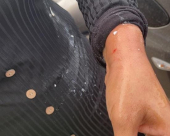 القاء البيض على سيدة يافاوية أثناء تواجدها في بات يام