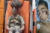 المأساة تتواصل بوفاة شقيق الطفل السوري عمران