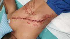  فيديو: اعتداء على شاب عربي من اللد وطعنه في ريشون لتسيون