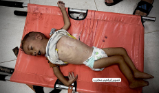 أحمد عبد العال.. رضيع آخر يقتله الجوع في غزة