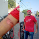 المواطن أبو إسماعيل شقرة من يافا: "راكب درّاجة دهسني بشارع النزهة، ولم يقدّم لي المساعدة"