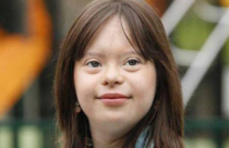 تخطّت مرضها ... أول مذيعة تعاني متلازمة "داون"