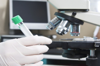 المختبرات الطبية في المستشفيات الحكومية تبدأ إضراباً اليوم 