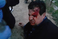 فيديو جديد يفضح تورّط الشرطة بالاعتداء على النائب أيمن عودة في أم الحيران