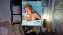 يافا: تدهوّر حالة أحد الأطفال المصابين بجريمة احراق البيت بالعجمي