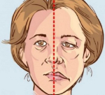 هل وصل "ضغط الدم" مرحلة الخطر؟ علامات على الوجه لا تتجاهلها