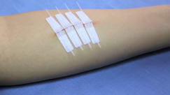 العلماء يكتشفون ضمادة ذكية لها مفعول السحر مع الجروح