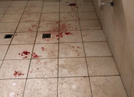 اصابة 5 طلاب بجراح متفاوتة اثر تعرضهم للطعن داخل مدرسة بجلجولية 