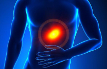 تخلص من حرقة المعدة بـ 6 خطوات فقط