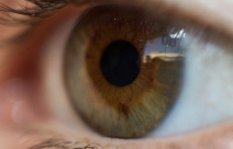 اصابة فتاة من المركز بالحول بسبب كثرة استعمال الهاتف