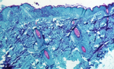 الصحة العالمية تدعو أوروبا إلى “تحرك عاجل” لمكافحة جدري القرود
