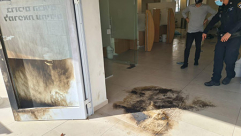 شخص يشعل النار بنفسه داخل عيادة في الرملة وحالته خطيرة   