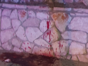 يافا: اصابة متوسطة لشاب بحادثة طعن 