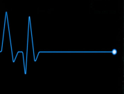 5 مراحل- هذا ما يحدث للجسم عقب الوفاة