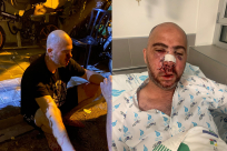  شاهد: لحظة اطلاق الرصاص المطاطي على وجه مواطن بيافا