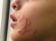  تعرّض الطفل "محمد" من اللد لاعتداءات متكررة داخل مدرسته العبرية