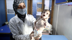 تقرير: الجوع يلتهم أطفال غوطة دمشق الشرقية