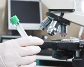 الخميس: إضراب الآلاف من عمال المختبرات عن العمل 