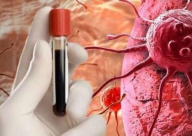 علماء يقترحون طريقة جديدة لمكافحة السرطان