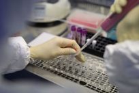  كورونا.. "لقاح الأمل" يدخل المرحلة النهائية