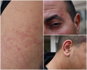  فيديو: شاب من يافا "الشرطة اعتدت عليّ ووالدي بوحشية وبربرية"