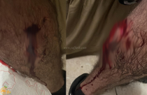  يافا: اصابة متوسطة لشاب عضّه كلب في حي الجبلية