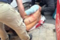 الرملة: إصابة خطرة لرجل باطلاق نار بعد تعرضه لعملية سطو 