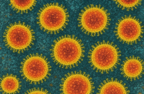 وزارة الصحة الإسرائيلية: تسجيل 32 إصابة بمرض الحصبة في مناطق مختلفة