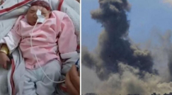 تشوهات خلقية مروّعة في غزة: ولادة طفلة دون دماغ تثير مخاوف طبية وحقوقية