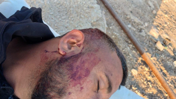 إصابات في صفوف الأهالي بقرية أم الخير جنوب الخليل جراء هجوم نفذه مستوطنون قبل قليل.
